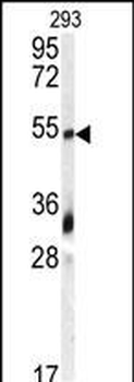 GDF10 Antibody (N-term)