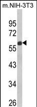 GDF10 Antibody (Center)
