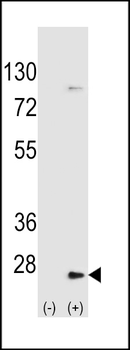 UBE2H Antibody (C-term)