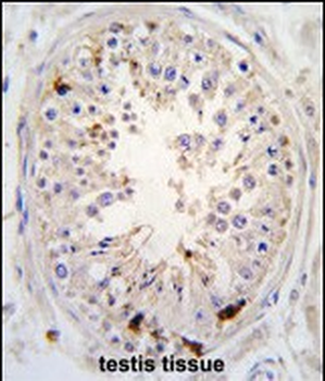 USP2 Antibody (C-term L523)