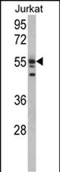 USP22 Antibody (N-term)