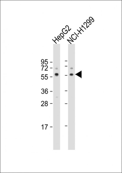 USP22 Antibody (N-term)