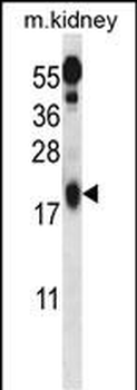 Ufc1 Antibody (C-term)