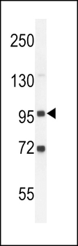 GPLD1 Antibody (C-term)