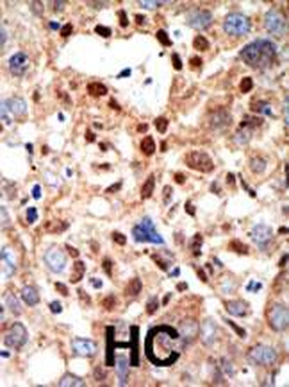 PML Sumoylation Site Antibody