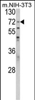 PABPC1 Antibody (Center)