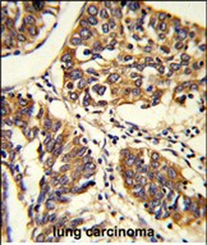 PABPC1 Antibody (Center)