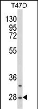 SNRPB Antibody (N-term R49)