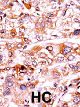 Phospho-P21CIP1(T57) Antibody