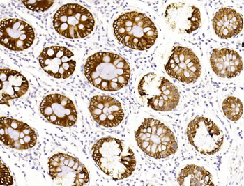 KRT19 Antibody