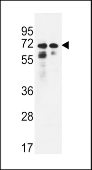 PNPLA8 Antibody (N-term)