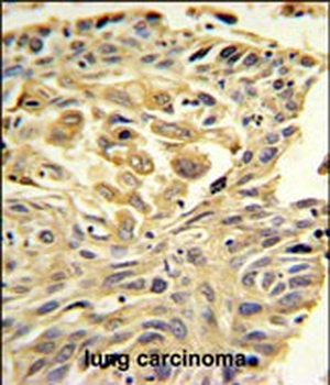 ZO1 Antibody (C-term)