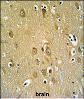SYTL2 Antibody (Center)