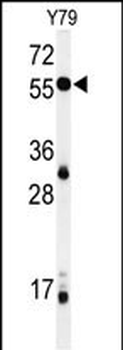 NOB1 Antibody (C-term)