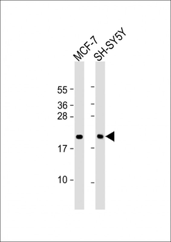 BTG1 Antibody (Center)