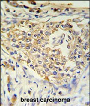 ADFP Antibody (Center)
