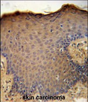 CXCL9 Antibody (C-term)