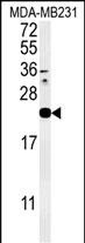 IL1F6 Antibody (Center)