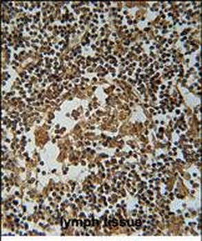 IL1F6 Antibody (Center)