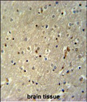 TTC26 Antibody (C-term)