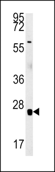 RBM24 Antibody (N-term)