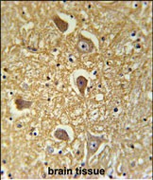 HAS2 Antibody (Center)