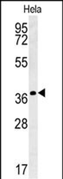 IL24 Antibody (C-term)