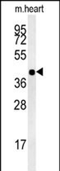 CRPPA Antibody (C-term)