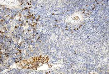 GREMLIN Antibody (C-term)
