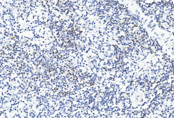 GREMLIN Antibody (C-term)