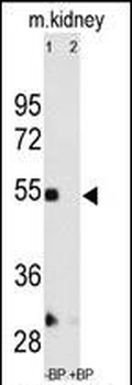 MMP12 Antibody (C-term)
