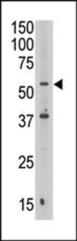 SEPT9 Antibody (C-term)