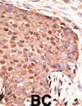 RAI17 Antibody (C-term)