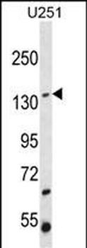 ST5 Antibody (C-term)