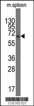 PARP3 Antibody (C-term)