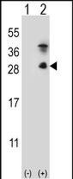 Kallikrein 7 Antibody (C-term)