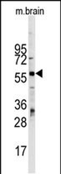 ZBTB7B Antibody (Center)