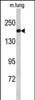 ALS2 Antibody (C-term)