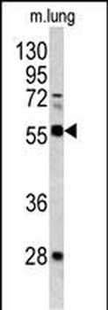FLI1 Antibody (Center)