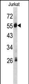 SERPING1 Antibody (Center)