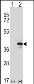 ZWINT Antibody (Center)