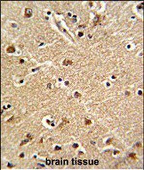 ZWINT Antibody (Center)