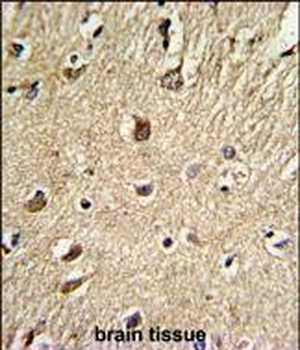 BGN Antibody (Center)