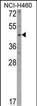 KYNU Antibody (C-term)