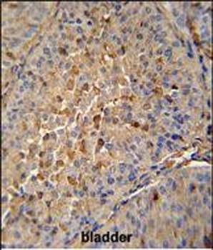 MAPRE1 Antibody (N-term)