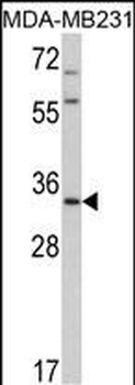 HPGD Antibody (C-term)