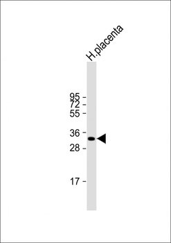 HPGD Antibody (C-term)