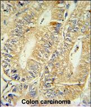 HPGD Antibody (C-term)