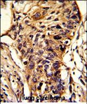 BCKDHA Antibody (C-term)