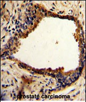 NDRG1 Antibody (N-term)